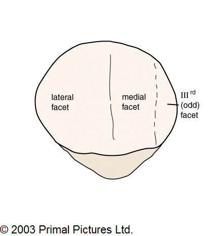 Medial Patellar Facet