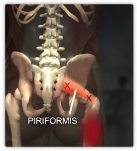 piriformis-skeleton