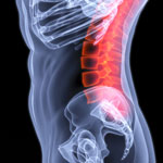 A lumbar spine