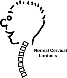 normal-neck